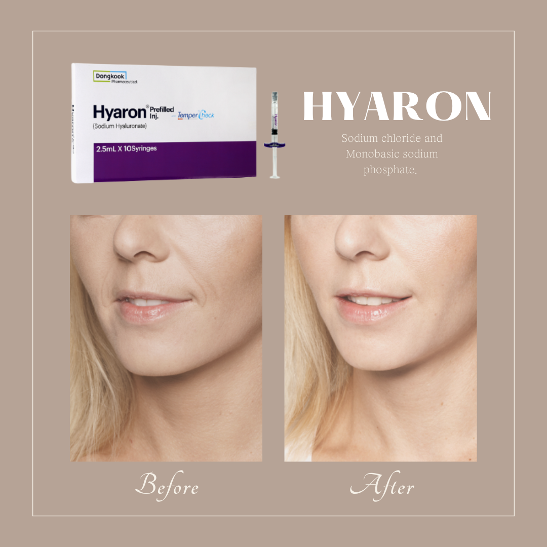 Buy Korea Hyaron Ha Filler Prefilled Injection Ml Hyaluronic Acid