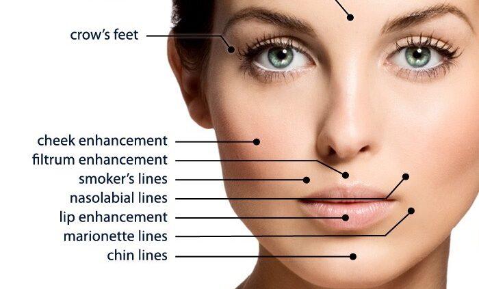8 Benefits of Facial Fillers at Ageless & Beautiful Med Spa San Diego