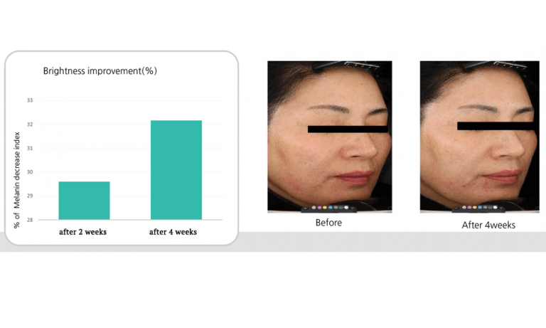rejuran healer before after