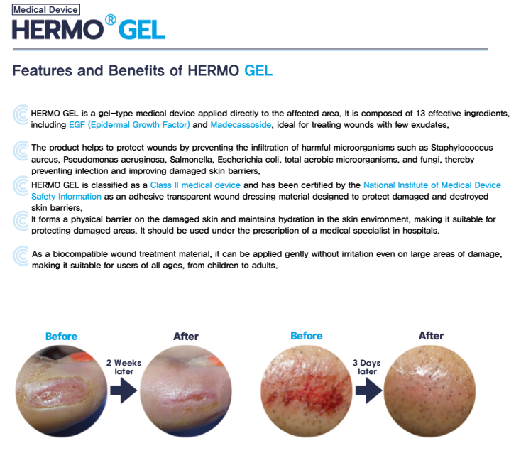 Buy [medical Device] Hermo Gel, Egf, Madecassoside, Wound Healing ...