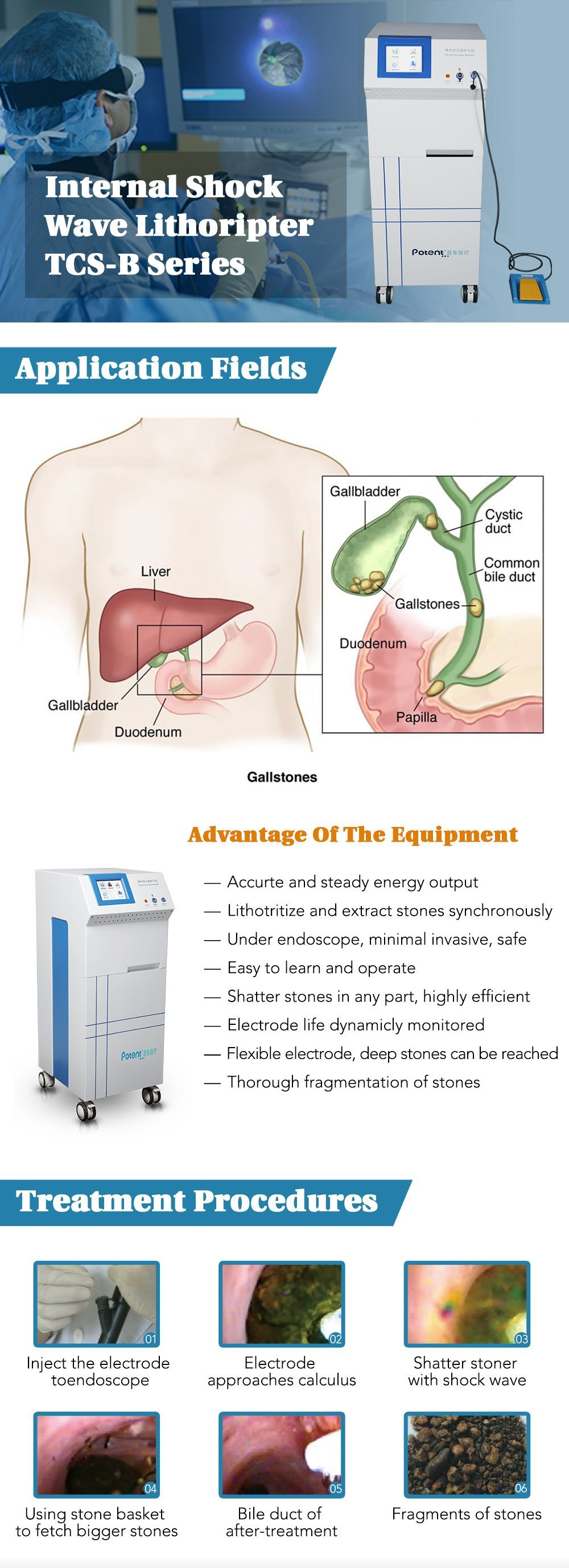 Buy Medical Internal Shock Wave Lithotripter Electrohydraulic ...