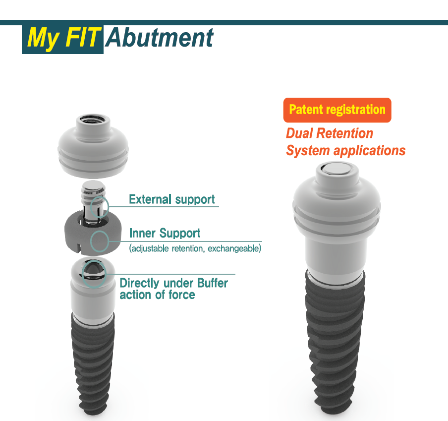 Buy Myfit / High Quality Korean Dental Implant Overdenture Abutment
