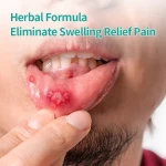 Mouth Ulcer Gel other oral hygiene products oral care mouth ulcer gel oral cream for mouth ulcer