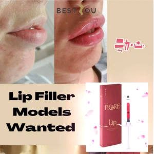 Korea Popular Treatment Priere Lips Filler Hyaluronic Acid Dermal Filler Ha Filler Contains Vitamins for Lips Enhanceme
