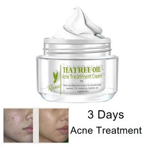Halal Skin Care Best Face Anti Acne Pimples Gel Acne Melasma Cream with customized Brand Name