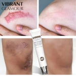 VIBRANT GLAMOUR Crocodile Repair Scar Gel Removal Scar Acne Cream Treatment Marks For Face Body Pigmentation Corrector Skin Care