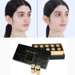 2025 korea Exosome Freeze-Dried Skin Booster Human Stem Cell Exosome P198 Exohealer Filcore