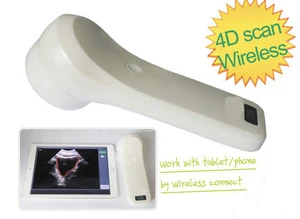 4D Ultrasound Scanner With Wireless Printer SIFULTRAS-5.5