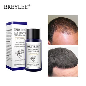 BREYLEE organic ginger hair growth essential oil free shipping
