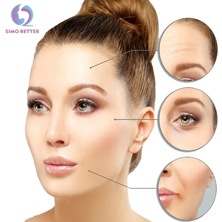 Face wrinkle 2ml injection dermal filler acido hialuronico gel