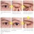 Fiber Strip Double sided Eyelid Tape /Sticker Invisible and Charming