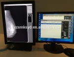 Mammography system high frequency analog mammography machine cr dr x ray equipment CE approved 6kw 80kHz
