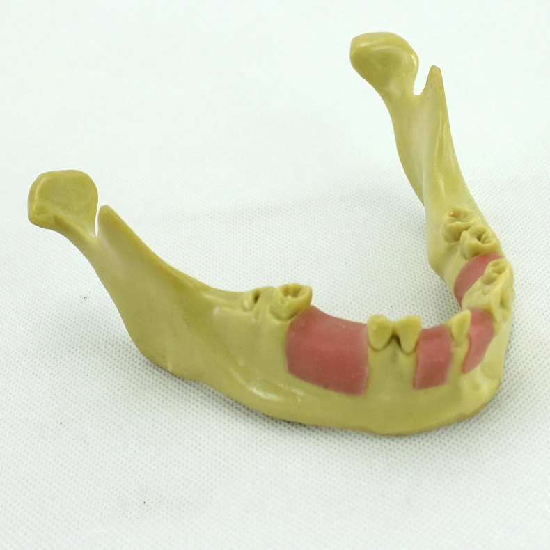 Medical &amp; Dental mandible implant model dental jaw dental implant model teeth model jaws