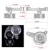 Import Adjustable EP3 Pulley Kit For Honda 8th 9th Civic All K20 &amp; K24 Engines with Auto Tensioner Keep A/C Installed CPY01/02 from China