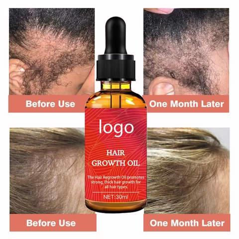Private Label Bulk Organic Vegan Hair Treatment Serum Wholesale Custom Herbal Anti Hair Loss Boosting Hair Growth Oil