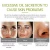 Import Tea Tree Anti-acne Face cream Acne Scar Cream Shrink Pores Facial Eliminates Acnes Cream Oil control Repair Spot from China