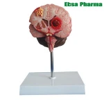 Advanced Medical Supplies Human Teaching Brain Epilepsy Anatomical Model For Medical School