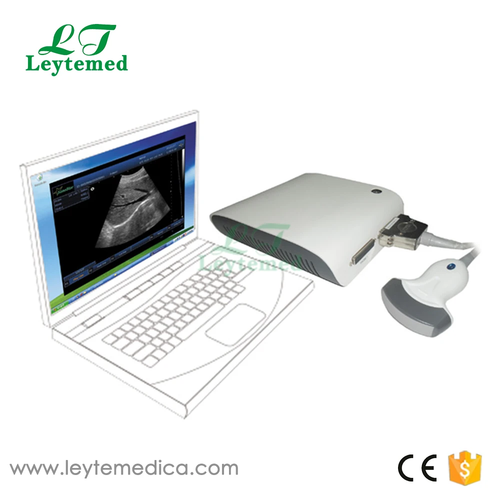 LTUB10 Full digital 3D image Ultrasound Box