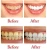 Import Private Label Baking Soda Press Remove Stain Whitening Toothpaste Fight Gums Toothpaste Fruit flavor from China