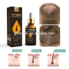 OEM ODM rosemary oil bottles loss treatment hair growth oil serum