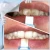 Import Cool invention 2021 Oral Hygiene Teeth Whitening Strips Professional Home Dental White Kits Tooth Cleaning from China