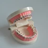 Dental Orthodontics Teeth Model Denture For Medical Science/Education Models