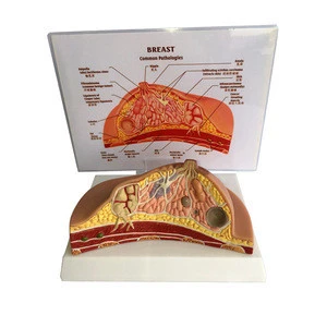 Medical Science Supplies Human Teaching Breast Cross-section Model