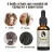 Import Natural Ingredient Effective Ginger Plant Extract  Hair Growth Treatment Oil for Hair Glow, Hair Loss from China