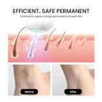 ODM OEM Sapphire Laser Hair Removal IPL Epilator Home Use Hot sell Ice Cooling Permanent Bikini Armpit for Women Men