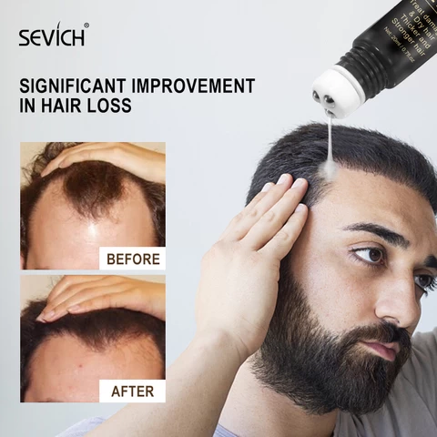 OEM factory hair growth serum ball Hair Thinning Therapy Energizing Scalp Serum Revitalizer
