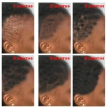 Best Quality Fast Grow Repair Treatment Hair Care Loss Treatment Hair Growth Oil Serum