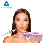 Fosydem Liquid Acid Form And Female Gender Cross-linked Hyaluronic Acid Gel 1ml For Lip