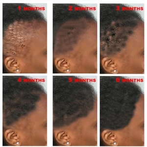 Sevich TOP sale biotin collagen hair growth oil Hair Loss Prevention Treatment 100% ginger care serum oil