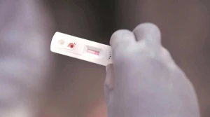 RT-PCR Test Kits (Viral)