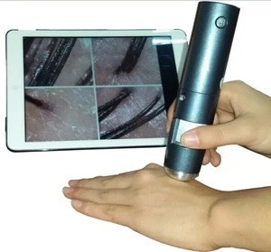 Free shipping IOS iphone smart 2MP 600X WIFI Digital LED  Scalp hair Detector microscope