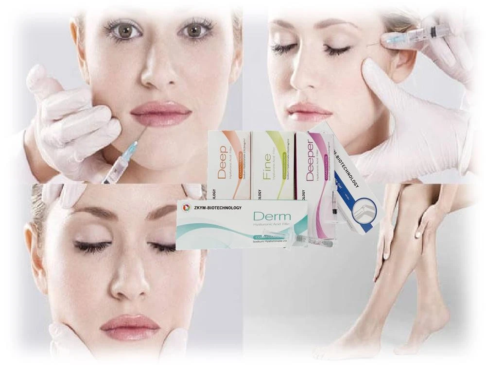 Top rated quality anti wrinkle injectable dermal filler facial hyaluronic acid dermal filler