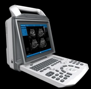 Portable LCD Ultrasound Scanner(OW-U50)