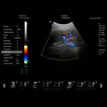 FM-K2 portable color doppler with 3d/4d software,color doppler ultrasound machine price Cine memory SSD Solid State Disk 64G