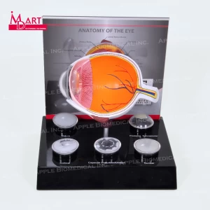 Human eye model with replaceable disease cataract lens in medical science