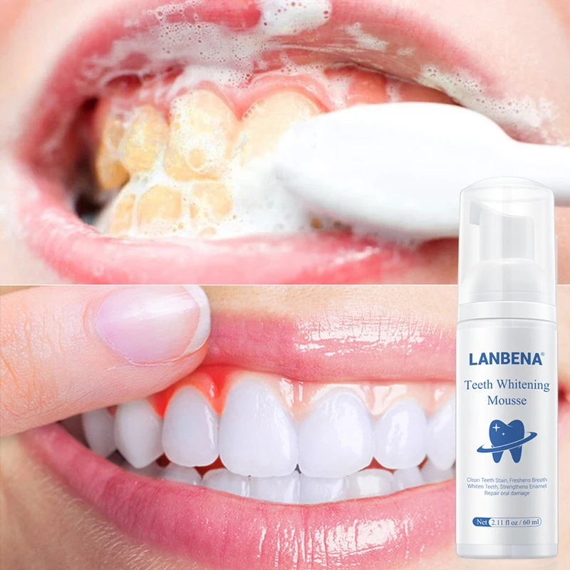 LANBENA Teeth Whitening Mousse Toothpaste Dental Oral Hygiene Remove Stains Plaque Teeth Cleaning Tooth White Tool New Version