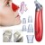 Import Beauty equipmentelectric ultrasonic blackhead remover / blackhead suction device for Strawberry nose from China