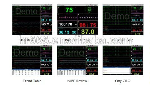 Hospital medical equipment Portable Multiparameter Patient Monitor 12 inch ICU CCU monitor price