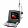 Vascular ultrasound elastography laptop machine portable color doppler