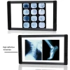 30w 60w 90w 120w medical ultra slim led x-ray viewer negatoscope