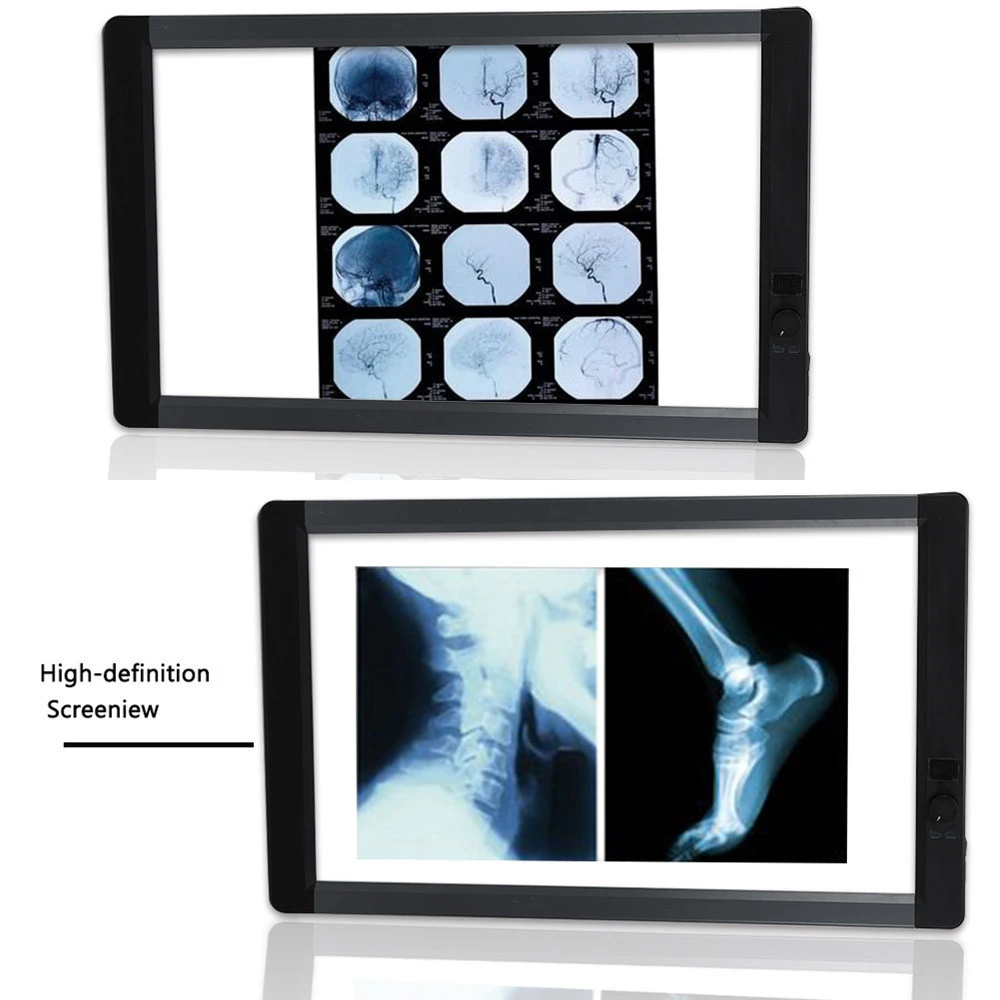 Negatoscope