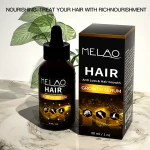 Private Label Reduces Dandruff Hair Repairment Moisturizing Hair Growth Oil Drops Biotin
