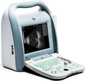 Ophthalmic Ultrasound AB scan