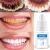 Import EFERO Teeth Whitening  Oral Hygiene Cleaning Serum Remove Plaque Stains Tooth Bleaching Tools Dental Care Toothpaste from China