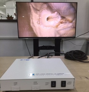 Medtech Microscope Buy Operation Microscope With Integrated 3d Video Recording System from ...