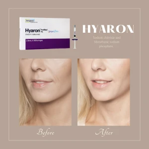 Korea Hyaron Ha Filler Prefilled Injection 2.5ml Hyaluronic Acid Skin Booster Solution